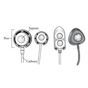 INNOWIZ CENTRAL VENOUS CATHETER WITH PORTS
